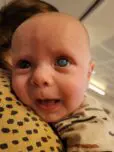 Foto van baby Guus die kinderglaucoom heeft