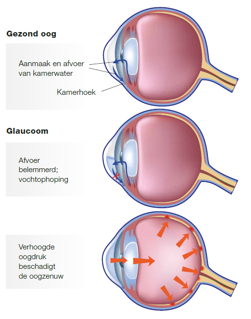 Anatomie afbeelding van oogbol