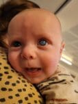 Foto van baby Guus die kinderglaucoom heeft
